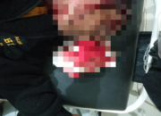 Sadis!! Wartawan Media Online di Majalengka Dibacok OTK