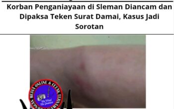Korban Penganiayaan di Sleman Diancam dan Dipaksa Teken Surat Damai, Kasus Jadi Sorotan